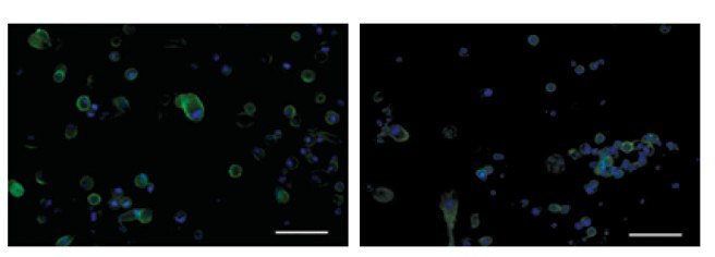 ICC for CD9, a cell surface glycoprotein, on PC-3 cells following a fixation protocol. Both in-plate staining using the CellASIC<sup>®</sup> ONIX Microfluidic Platform <strong>(left)</strong> and the Millicell<sup>®</sup> EZ <sub>SLIDE</sub> <strong>(right)</strong> show similar staining patterns. ICC for CD9, a cell surface glycoprotein, on PC-3 cells following a fixation protocol