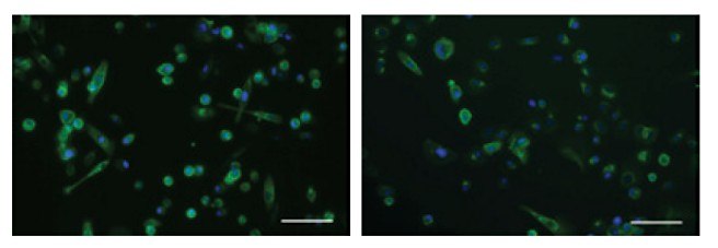 ICC for cytokeratin 19, an intracellular intermediate filament protein, in PC-3 cells following a fixation/permeabilization protocol. Both in-plate staining using the CellASIC® ONIX Microfluidic Platform <strong>(left)</strong> and the Millicell<sup>®</sup> EZ <sub>SLIDE</sub> <strong>(right)</strong> show similar staining patterns. ICC for cytokeratin 19, an intracellular intermediate filament protein