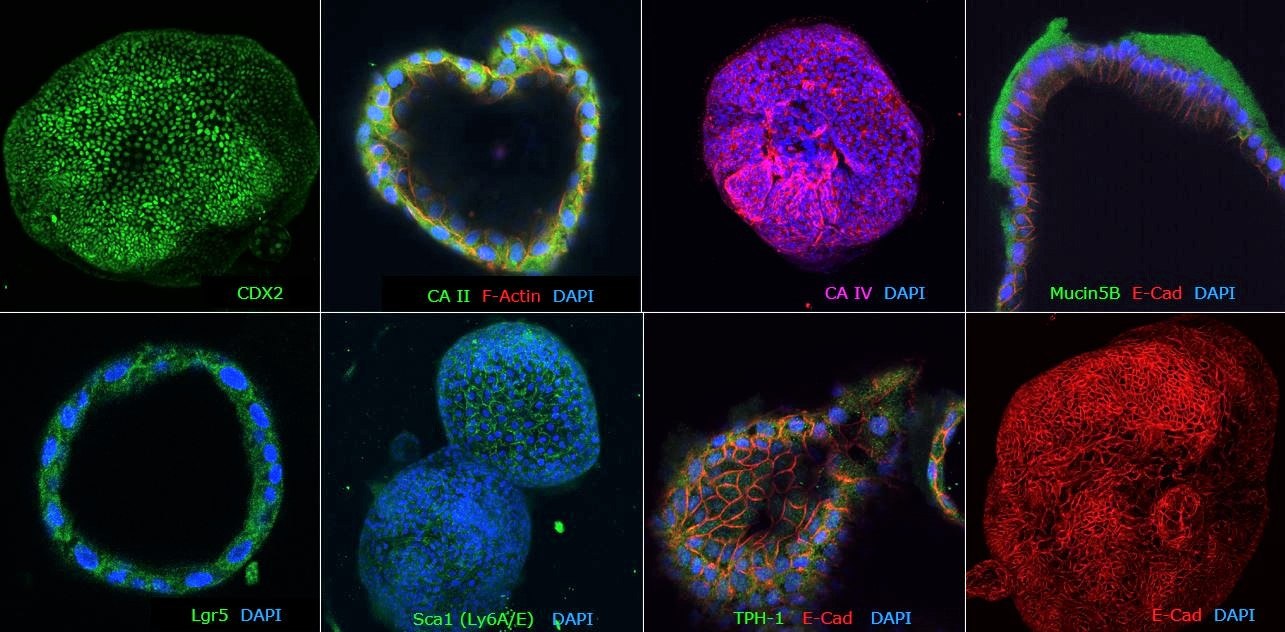 Fig2: Figure 2. Immunocytochemical characterization of human colon organoids (Colon-87, SCC321). Human colon PDOs are positive for colon-specific markers: CA II, CA IV and Mucin5B, posterior hindgut marker: CDX2, stem cell markers: Lgr5 and Sca1 and epithelial markers: TPH-1 and E-Cad.