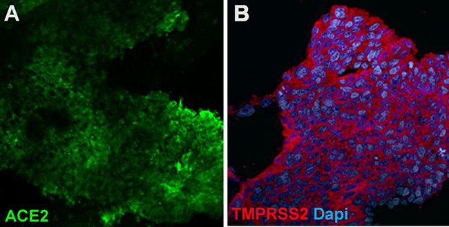 lung-bud-organoids-express-ace-and-tmprss