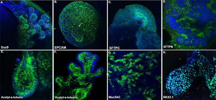 lung-organoid-marker-expression