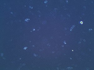 Precipitation from brand new calf serum