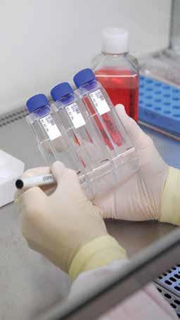 EBV transformed cells EBV transformed cells