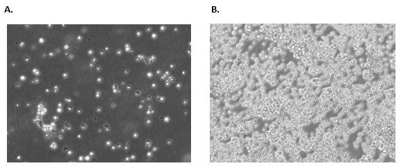 Examples of a suspension cell line. <a href="/product/sigma/cb_88042803">Jurkat E6.1</a> cells 24 hours (A) and 72 hours (B) post freeze/thaw show typical suspension lymphoblastic morphology. Confluence should carefully be monitored and passaged when cells reach ~80% confluency. suspension cell line