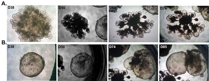 time-course-human-lung-organoid-maturation