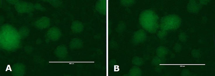 Immunocytochemistry Analysis of mESC colonies. mESC colonies were cultured on 0.1% gelatin coated solid bottom plastic plates with media filtered once (a) or 5 times (b). Colonies were fixed with 3.7% formaldehyde and permeabilized with 0.1% saponin. Expression of Oct-4 was determined with primary anti-Oct-4 antibody followed by visualization with a Cy3 conjugated secondary antibody. Immunocytochemistry Analysis of mESC colonies