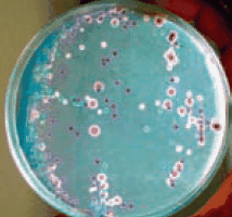 Candida Ident Agar, modified (Candida albicans = green-coloured smooth colonies, Candida tropicalis = blue to metallic blue-coloured raised colonies. Candida glabrata = cream to white, Candida krusei = purple coloured fuzzy colonies) Candida Ident Agar, modified