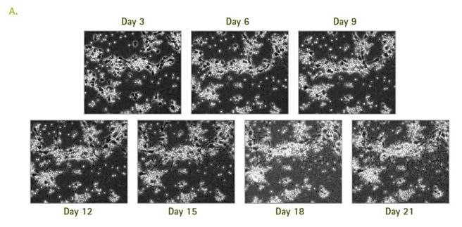 Neurite outgrowth in the microfluidics-cultured rat primary cortical neurons Neurite outgrowth in the microfluidics-cultured rat primary cortical neurons