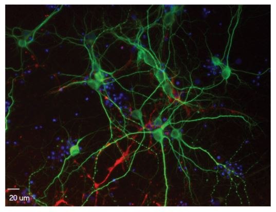 Immunocytochemistry of the rat primary cortical neurons cultured, stained and analyzed on the microfluidic platform. The primary cortical neurons were cultured on the device for 19 days, and the neuron marker (MAP2, green) and the astrocyte marker (GFAP, red) were identifed by immunocytochemistry using anti-MAP2 and antiGFAP antibodies. Nuclei were stained with Hoechst 33342 (blue). Immunocytochemistry of the rat primary cortical neurons