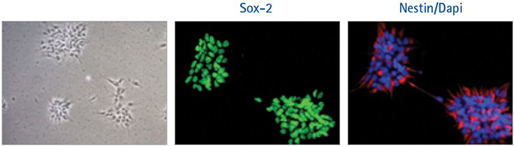 ENStem™-A neural progenitor cells grown for 3 passages in HumanKine®