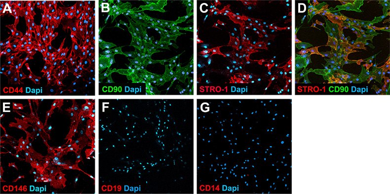 Immunocytochemical staining of cultured human bone marrow-derived mesenchymal stem cells stained with antibodies provided in the kit. Nuclei of the cells were visualized with DAPI (blue). CD19 and CD14 staining were not present on human mesenchymal stem cells. Immunocytochemical staining of cultured human bone marrow-derived mesenchymal stem cells stained