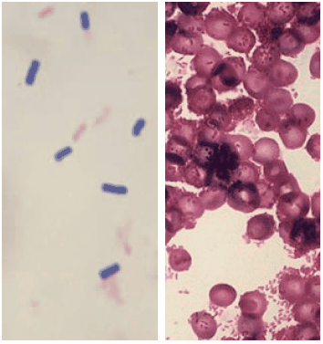 Gram staining (on the left Gram-positive Bacilus cereus, on the right Gram-negative Citrobacter).