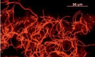 Fluorescence-marked Microthrix parviacella in activated sludge; Source: © Bayerisches Landesamt für Umwelt