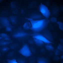 BFP expression in A549-Cas9-Blast stable cells infected with arrayed CRISPR lenti-gRNA viruses, seven days post infection, 20X magnification BFP expression in A549-Cas9-Blast stable cells infected with arrayed CRISPR lenti-gRNA viruses, seven days post infection, 20X magnification