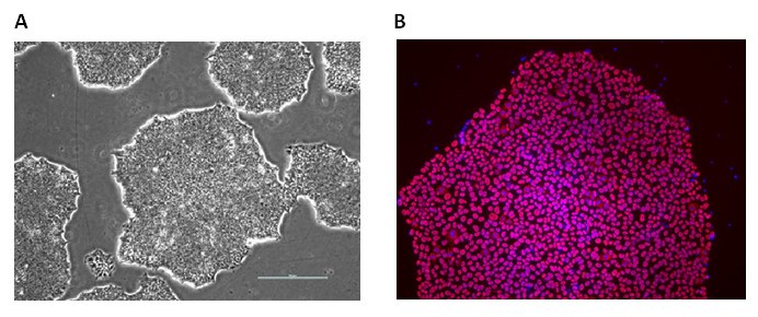 ApoE polymorphic alleles are the principal genetic determinants of Alzheimer disease (AD) risk. The EBiSC stem cell bank contains a complete set of isogenic lines, CRISPR engineered by Bioneer A/S, with the main ApoE genotypes: ApoE 2/2 (BIONi010-C-6), ApoE 3/3 (BIONi010-C-2) and ApoE 4/4 (BIONi010-C-1) as well as an ApoE knockout line (BIONi010-C-3) and TREM2 gene knockouts with homozygous R47H SNPs (BIONi010-C-7) or a homozygous T66M SNPs (BIONi010-C-8). A) iPS cells display normal undifferentiated phenotypes with colonies having clear defined borders and B) express the pluripotency marker Oct-4 (B). Alzheimer’s Human iPS Cell Lines