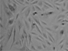 Cell growth after puromycin selection for four days - Infected with Virus Cell growth after puromycin selection for four days - Infected with Virus