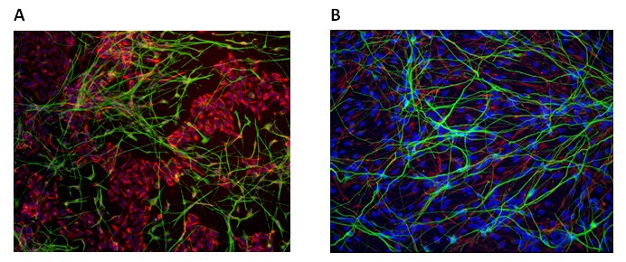 CRISPR engineered human iPS cells can be differentiated into neural phenotypes with Nestin (A, red) and b-Tubulin (A, green) expression or glial phenotypes with GFAP (B, green) expression. Neural Differentiation of Human iPS Cell Lines