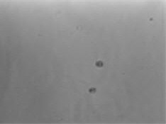 Cell growth after puromycin selection for four days Cell growth after puromycin selection for four days