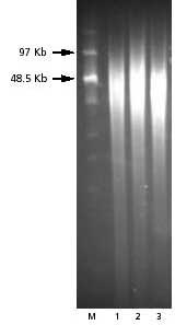 Purified genomic DNA was isolated from various bacterial species using the GenElute Bacterial Genomic DNA kit. A 1 µg aliquot of DNA from each respective bacterial sample was resolved on a 1% agarose gel in 0.5X TBE at 150 volts for 16 hours using a BioRad CHEF DRII system. The initial pulse time was 2 seconds, the final pulse time was 13 seconds, the start ratio was 1.0, pump speed was set at 70, and PFGE was carried out at 4 °C. Marker (M) represents the 0.1-200 kb Pulse marker (<a href="/product/SIGMA/D2291">Product No. D2291</a>). GenElute Bacterial Genomic PFGE