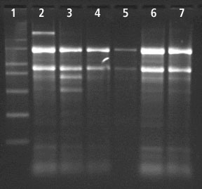 Total RNA Extraction from Sugarcane Leaf using Spectrum™ Total RNA kit Total RNA Extraction from Sugarcane Leaf using Spectrum™ Total RNA kit