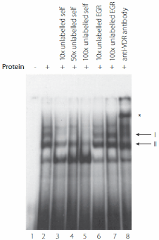 in-vitro-expression In-Vitro