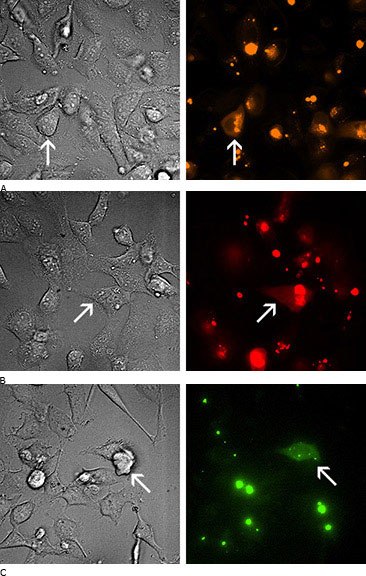 Microscopic images of treatment cells. <b>A</b>) DIC (differential interference contrast) and fluorescence microscopy of SIC003 Fluorescent Universal Negative Control #1 w/Cyanine 3 (excitation: 550 nm & emission: 570 nm; RFP filter excitation: 555 nm ±25 & detection: 605 nm ±52) <b>B</b>) DIC and fluorescence microscopy of SIC005 Fluorescent Universal Negative Control #1 w/Cyanine 5 (excitation: 650 nm & emission: 670 nm; Cyanine 5 filter excitation: 320 nm ±60 & detection: 700 nm ±75) and <b>C</b>) DIC and Fluorescence microscopy of Fluorescent SIC007 Universal Negative Control #1 w/6-FAM (excitation: 495 nm & emission: 516 nm; GFP filter excitation: 490 nm ±20 & detection: 525 nm ±36). Arrows indicate a cell where fluorescence is evident. Microscopic images of treatment cells.