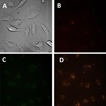 Microscopic images of control cells (treated only with transfection reagent). <b>A</b>) DIC <b>B</b>) Fluorescent Cyanine 5 filter <b>C</b>) Fluorescent GFP filter and <b>D</b>) Fluorescent RFP filter. Some autofluorescence is visible. However, it is very dim compared to the Fluorescent Universal Negative Controls w/Cyanine 3, Cyanine 5 & 6-FAM. Microscopic images of control cells (treated only with transfection reagent).