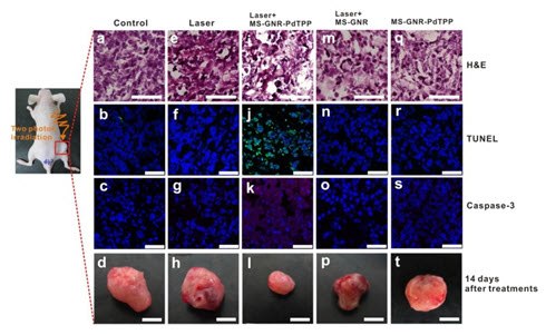In vivo studies illustrating two-photon activated photodynamic therapy following intra-tumor injection of mesoporous silica-coated gold nanoRod-PdTPPs. Histologic analyses of harvest tumor sections 24 hours post-irradiation were made with hematoxylin and eosin (first row) TUNEL (second row, green coloring), caspase-3 immuno-histogram (third row, red coloring) and DAPI (blue coloring) staining. Inhibition of tumor growth, indicated by staining with apoptosis indicators TUNEL and Caspase-3, was observed with combined mesoporous silica-coated Gold NanoRod-PdTPPs treatment and laser irradiation (1.2 times, figure 6i). (Source: Reprinted with permission from Theranostics. 2014; 4(8): 798–807) In vivo studies illustrating two-photon activated photodynamic therapy