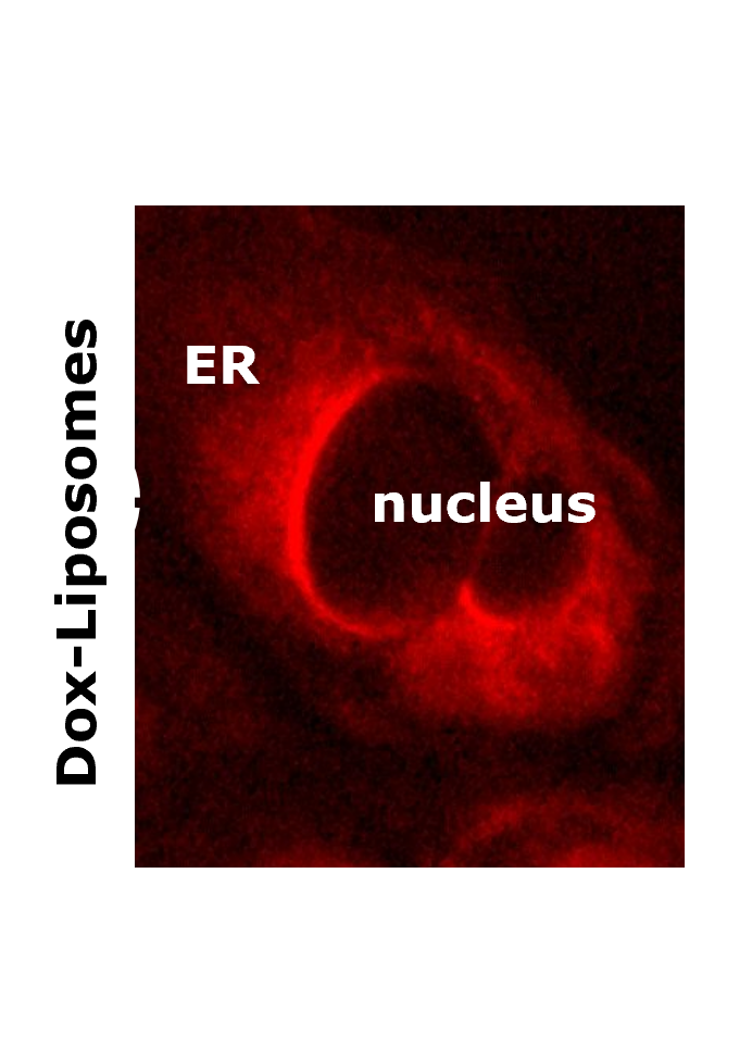A photo of the endoplasmic reticulum of cancer cells A photo of the endoplasmic reticulum of cancer cells.