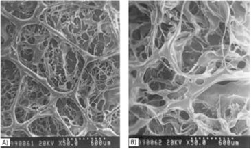 The SEM images of bilayer chitosan sponges designed as an artificial skin prepared by the sucrose leaching method: A) 4.5% sucrose in chitosan solution as a porogen; B) 6% sucrose in chitosan solution as a porogen. The SEM images of bilayer chitosan sponges