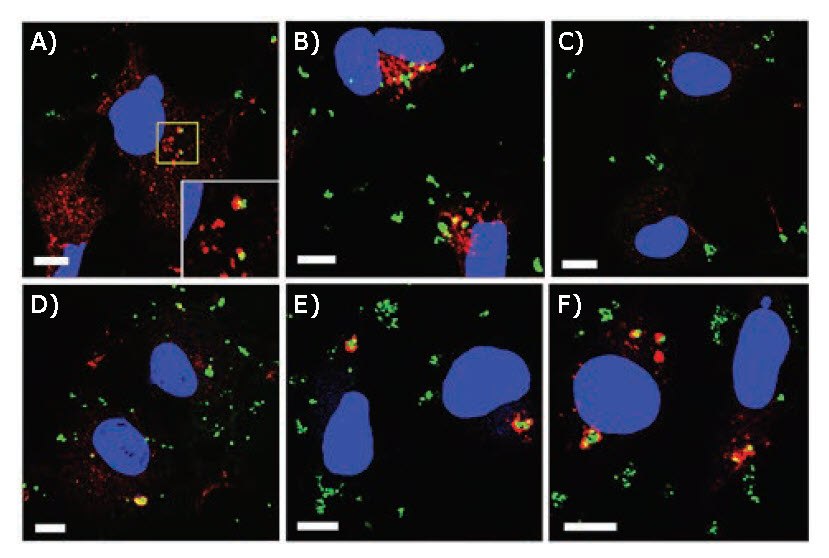 CLSM images of MPNB-transfected COS-1 cells after incubation for A) 30 min and B) 1 h for Vps26 staining, and C) 30 min, D) 1 h, E) 2 h, and F) 4 h for LC3 staining. Blue and green represent nuclei and MPNBs, respectively. Red represents Vps26 (A,B) or LC3 (C–F). Scale bars correspond to 10 μm. The inset shown at the bottom right of (A) is a magnified view of the region enclosed by the yellow line in (A). Reprinted with permission from reference 47, copyright 2017 American Chemical Society. CLSM images of MPNB-transfected COS-1 cells