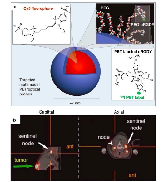 Multimodal silica nanoparticles for targeted cancer diagnosis in a model of human melanoma. Multimodal silica nanoparticles for targeted cancer diagnosis in a model of human melanoma.