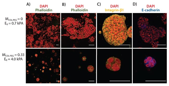 Effects of hydrogel elastic modulus E0 on proliferation of 3D hepatocarcinoma spheroids. A,B) Spheroids formed within the pure collagen gel (E0 = 9.7 kPa; 1st row) were larger and more disorganized than those formed within the collagen-PEG gels (E0 = 4.0 kPa; 2nd row). Intracellular actins were stained with phalloidin (green), and the nuclei were stained with DAPI (red). Images in B) are magnified views of spheroids shown in A). C) Spheroids grown in the pure collagen gel displayed higher integrin expression (yellow) than those grown in the collagen-PEG gel. Cell nuclei were stained with DAPI (red). D) Spheroids grown in the collagen-PEG gel expressed higher levels of E-cadherin (blue) compared to those grown in the pure collagen gel. Cell nuclei were stained with DAPI (red). Scale bars represent 50 μm.<sup>23</sup> Effects of hydrogel elastic modulus