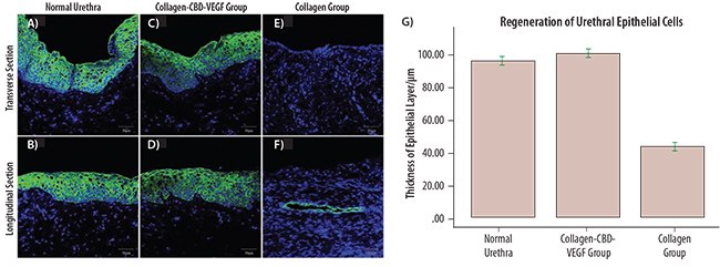 Immunofluorescence staining of the normal urethra (A,B) and neo-urethra at 6 months after urethral reconstruction (C,D,E,F) with mouse monoclonal antibodies against pan-cytokeratin antibody (ab86734). The epithelium covered the total segment of neo-urethra, and the mean thickness of the epithelial layer was similar to normal urethra in the collagen-CBD-VEGF group (C,D). However, the neo-urethra was not covered by a complete epithelial layer at the central section of the neo-urethra, and fistulas were generally observed in the collagen group (E,F). The mean thickness of the epithelial layer in the collagen-CBD-VEGF group was significantly larger than that in collagen group (G).<sup>19</sup> Immunofluorescence staining of the normal urethra
