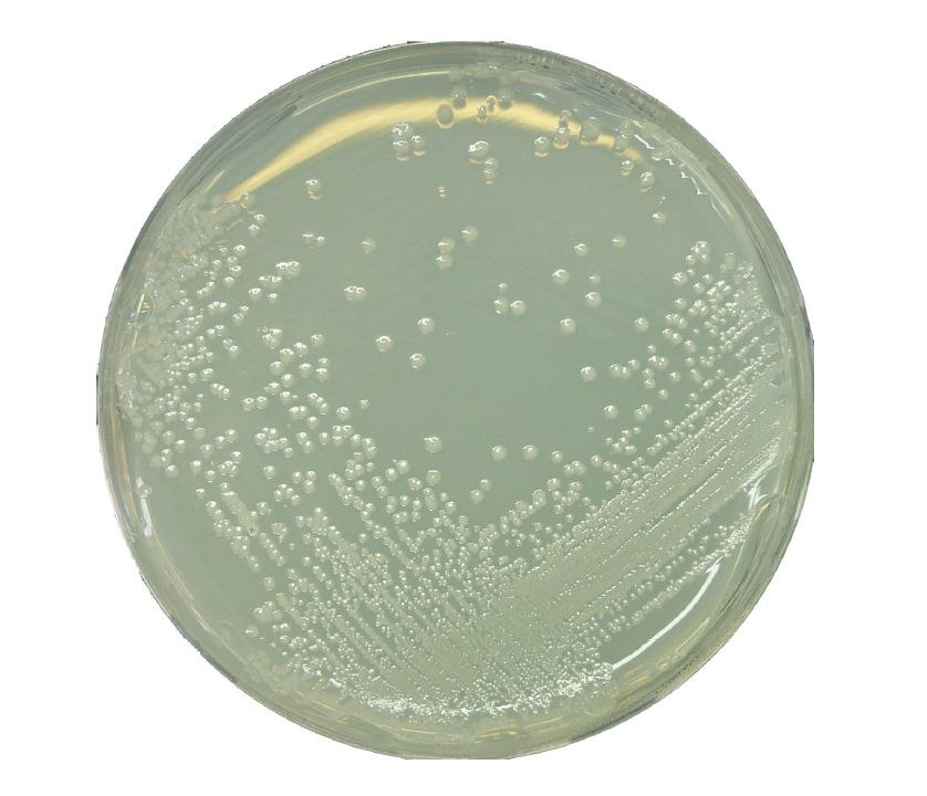 <i>Alicyclobacillus</i> spp. on BAT Agar <i>Alicyclobacillus</i> spp. on BAT Agar