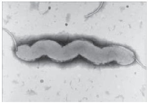 Electron micrograph of Campylobacter jejuni (Gaynor et al. 2004) Electron micrograph of Campylobacter jejuni (Gaynor et al. 2004)