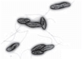 Electron microscope image of Campylobacters by Jochen Reetz, Bundesinstitut für Risikobewertung (BfR), Germany Electron microscope image of Campylobacters