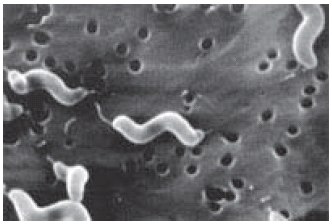 Scanning electron micrograph of the single polar flagellum and corkscrew shape of C. jejuni. These morphologic characteristics contribute to the characteristic darting motility of C jejuni in the viscous mucous layer of the intestinal lumen. Sean F. Altekruse National Cancer Institute, Rockville Scanning electron micrograph