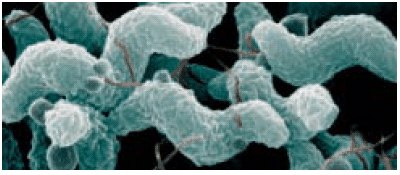 Scanning electron microscope image: shows the characteristic spiral, or corkscrew, shape of C. jejuni cells. Photo by De Wood; digital colorization by Chris Pooley, USDA/ARS Scanning electron microscope