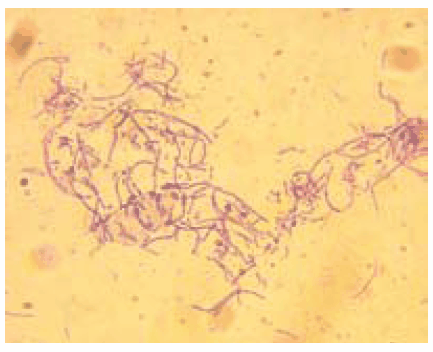 Microscopic picture from <em>Bacillus anthracis</em> Microscopic picture from Bacillus anthracis