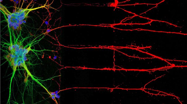 Immunocytochemistry (ICC) locates proteins associated with neuronal nuclei, soma, and axons Immunocytochemistry (ICC) locates proteins associated with neuronal nuclei, soma, and axons