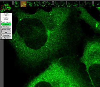 Anti-CCNB1 (cyclin B1) Immunofluorescence image with antibody staining. Anti-CCNB1 (cyclin B1) Immunofluorescence image with antibody staining.