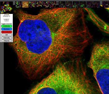 Anti-CCNB1 (cyclin B1) IF image with antibody staining, nucleaus staining and microtubule staining. Anti-CCNB1 (cyclin B1) IF image with antibody staining, nucleaus staining and microtubule staining.