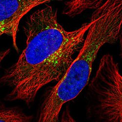 Anti-COPG1 antibody shows localization to the Golgi apparatus using IF staining. Anti-COPG1 antibody shows localization to the Golgi apparatus using IF staining.