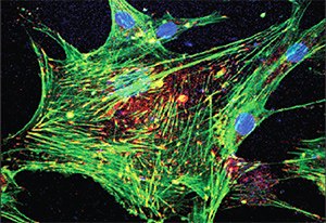 Immunofluorescence. Primary human osteoblast cells labeled with Anti- Vinculin
