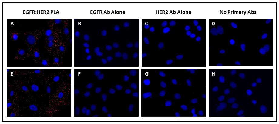 Detection of EGF-induced EGFR:HER2 dimerization using Duolink® PLA