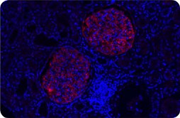 Application example of in situ PLA® 