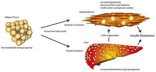 Adipose Expandability Hypothesis