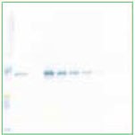 Western Blotting and Immunohistochemistry