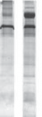 Comparison of SDS-PAGE Clean-Up Kit with ethanol precipitation. (A) Urinary protein precipitated with 10 volumes of ethanol. (B) Urinary protein precipitated with SDS-PAGE Clean-Up Kit. Gel: 8 × 9 cm, 12.5% acrylamide, 0.1% SDS, run on SE 260 Mini-Vertical Unit. Stain: Coomassie** Blue R-250. Comparison of SDS-PAGE Clean-Up Kit with ethanol precipitation